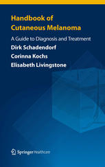 Handbook Of Cutaneous Melanoma A Guide To Diagnosis And Treatment 1st Edition Dirk Schadendorf