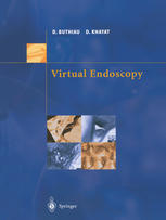 Virtual Endoscopy 1st Edition M Dousset D Buthiau C Dugas