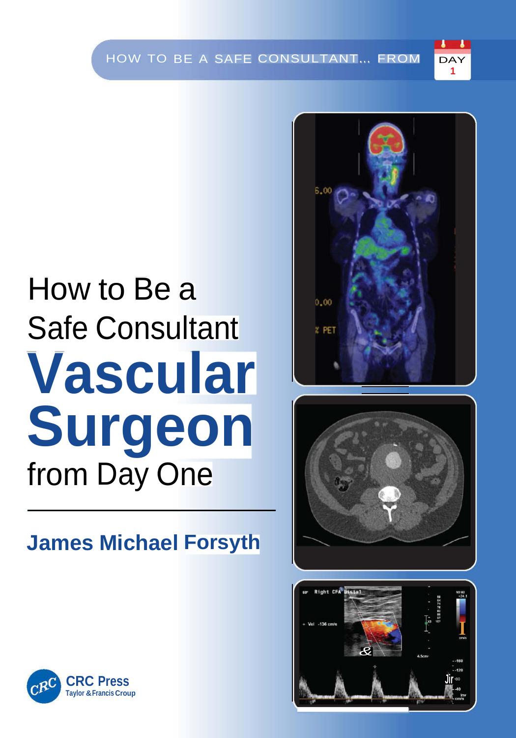 How To Be A Safe Consultant Vascular Surgeon From Day One The Unofficial Guide To Passing The Frcs Vasc James Michael Forsyth