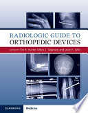 Radiologic Guide To Orthopedic Devices Illustrated Edition Tim B Hunter