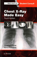 Chest Xray Made Easy 4th Edition 4th Jonathan Corne Maruti Kumaran