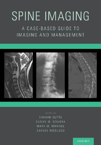 Spine Imaging Illustrated Shivani Gupta Daniel M Sciubba Mark M Mikhael