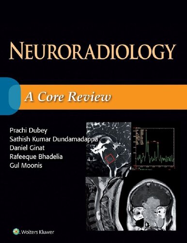 Neuroradiology 1st Edition Prachi Dubey Sathish Kumar Dundamadappa
