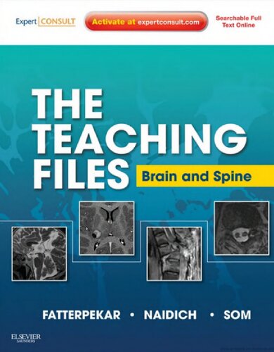 The Teaching Files Brain And Spine Expert Consult Online And Print 1st Edition Girish Fatterpekar Md
