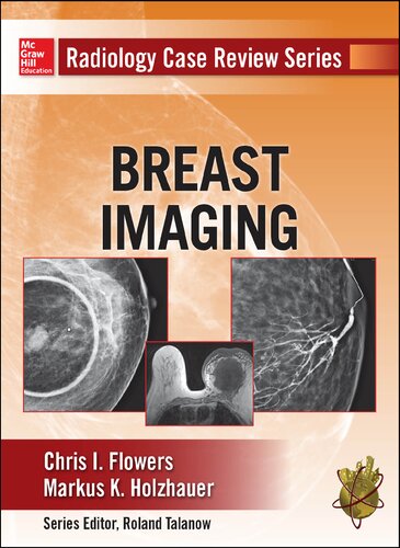 Radiology Case Review Series Breast Imaging Chris Flowers Markus Holzhauer