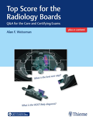 Top Score For The Radiology Boards 1st Edition Alan Weissman