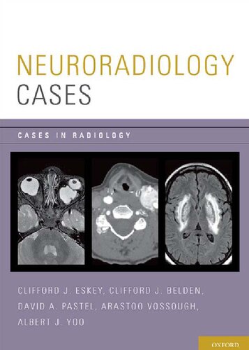 Neuroradiology Cases Illustrated Clifford J Eskey Clifford J Belden