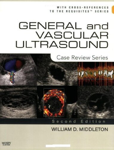 General And Vascular Ultrasound Case Review Series 2nd Edition William D Middleton Md Facr