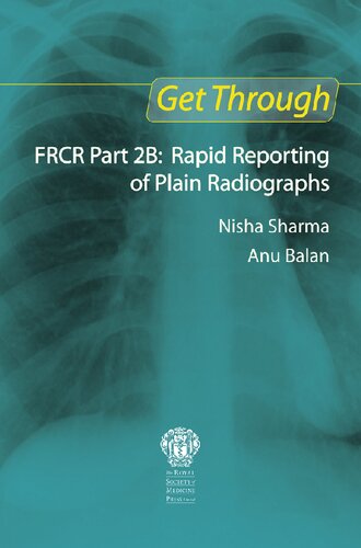 Get Through Frcr Part 2b Rapid Reporting Of Plain Radiographs Nisha Sharma