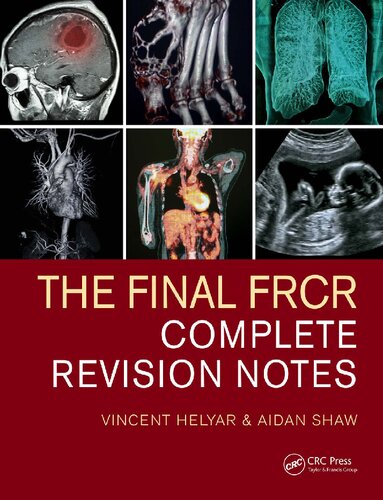 The Final Frcr Complete Revision Notes 1st Edition Vincent Helyar
