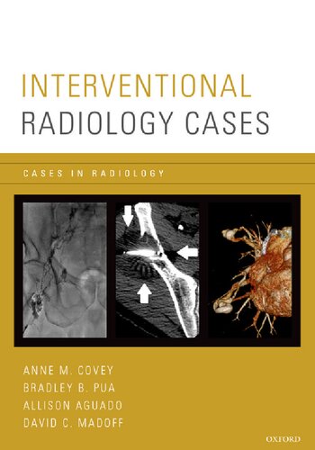 Interventional Radiology Cases Cases In Radiology 1st Edition Anne M Covey Editor