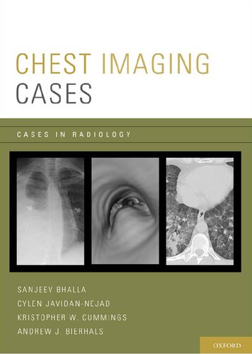 Chest Imaging Cases Illustrated Sanjeev Bhalla Cylen Javidannejad