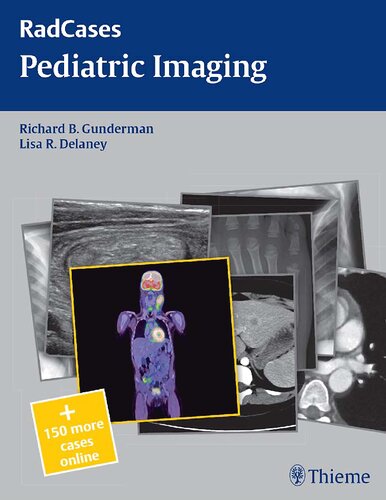 Pediatric Imaging Radcases 1st Edition Richard B Gunderman Editor
