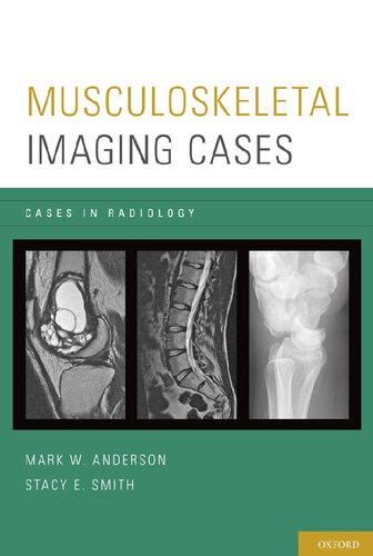 Musculoskeletal Imaging Cases Cases In Radiology Illustrated Mark W Anderson