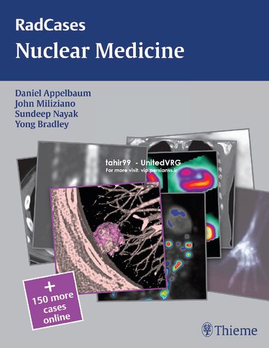 Radcases Nuclear Medicine Radcases Plus Qa 1st Edition Daniel E Appelbaum