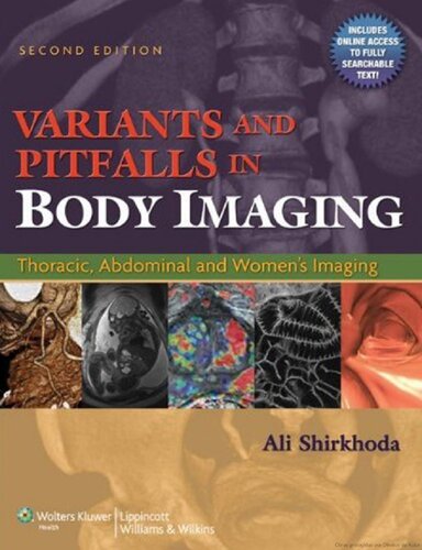 Variants And Pitfalls In Body Imaging Thoracic Abdominal And Womens Imaging 2nd Edition 2nd Edition Ali Shirkhod