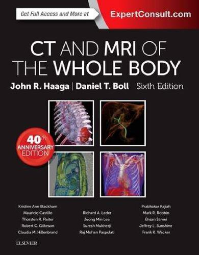 Ct And Mri Of The Whole Body Volume 1 Of 2 6th Edition 6th Edition John R Haaga And Daniel Boll