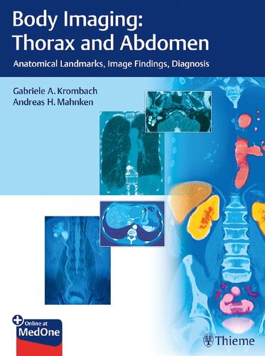 Body Imaging Thorax And Abdomen Anatomical Landmarks Image Findings Diagnosis 1st Edition Gabriele A Krombach Editor