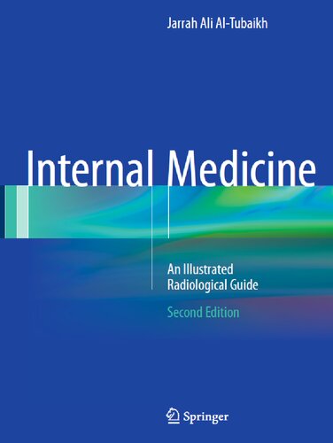 Internal Medicine An Illustrated Radiological Guide 2nd Edition 2nd Ed 2017 Jarrah Ali Altubaikh