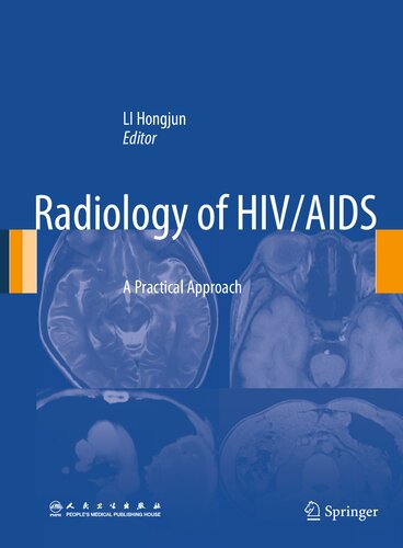 Radiology Of Hivaids A Practical Approach 2014th Edition Hongjun Li Editor