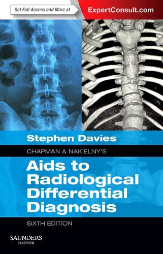 Chapman Nakielnys Aids To Radiological Differential Diagnosis Expert Consult Online And Print 6th Edition Stephen G Davies Ma Mb Bchir Mrcp Frcr