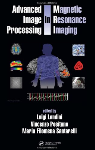 Advanced Image Processing In Magnetic Resonance Imaging 1st Edition Luigi Landini