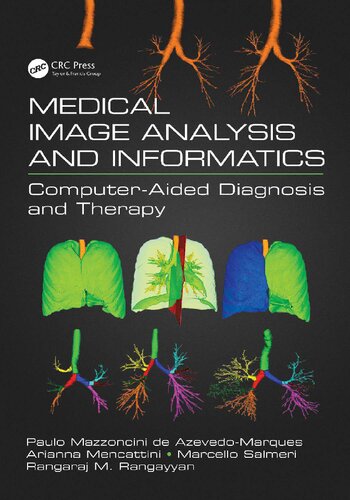 Medical Image Analysis And Informatics Computeraided Diagnosis And Therapy 1st Edition De Azevedomarques Paulo Mazzoncini