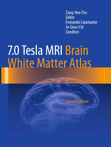 70 Tesla Mri Brain White Matter Atlas 2nd Ed 2015 Zanghee Cho Editor