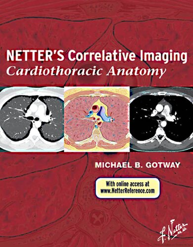 Netters Correlative Imaging Cardiothoracic Anatomy 1st Edition Michael Gotway