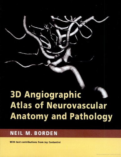 3d Angiographic Atlas Of Neurovascular Anatomy And Pathology 1st Edition Neil M Borden Md
