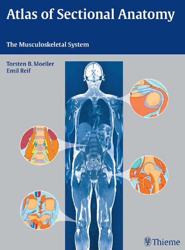 Atlas Of Sectional Anatomy The Musculoskeletal System Illustrated Torsten Bert Mller