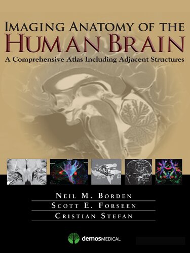 Imaging Anatomy Of The Human Brain A Comprehensive Atlas Including Adjacent Structures 1st Edition Neil M Borden