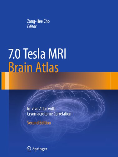 70 Tesla Mri Brain Atlas Invivo Atlas With Cryomacrotome Correlation 2nd Ed 2015 Zanghee Cho Editor