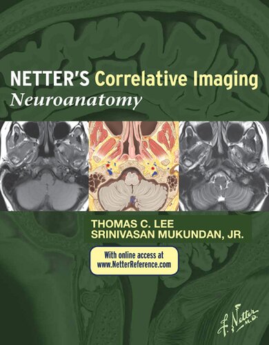Netters Correlative Imaging Neuroanatomy With Netterreferencecom Access 1e 1st Edition Thomas C Lee Md
