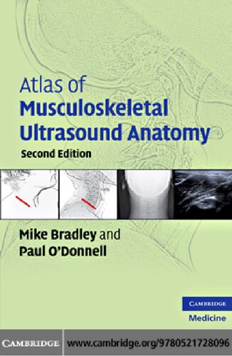 Atlas Of Musculoskeletal Ultrasound Anatomy 2nd Edition Mike Bradley