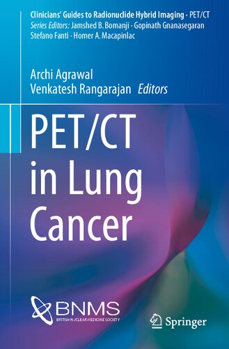Petct In Lung Cancer Clinicians Guides To Radionuclide Hybrid Imaging 1st Ed 2018 Archi Agrawal Editor