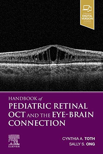 Handbook Of Pediatric Retinal Oct And The Eyebrain Connection 1st Edition Cynthia A Toth Md