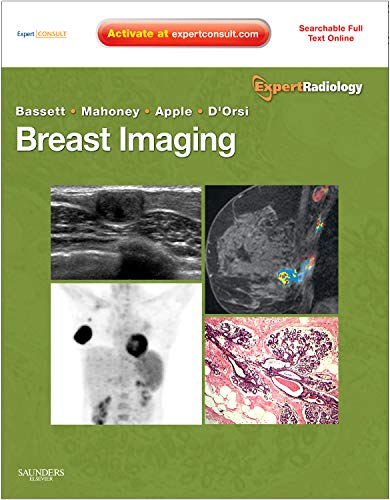 Breast Imaging Expert Radiology Series 1st Edition Lawrence W Bassett Md