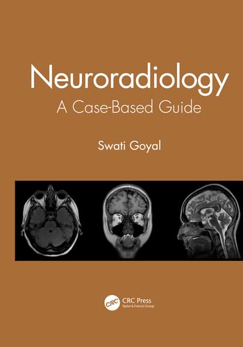 Neuroradiology 1st Edition Swati Goyal