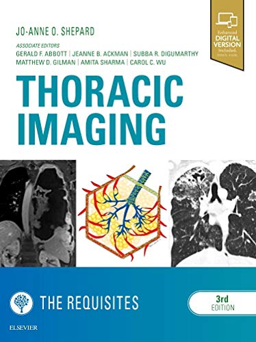 Thoracic Imaging The Requisites Requisites In Radiology 3rd Edition Joanne O Shepard Md