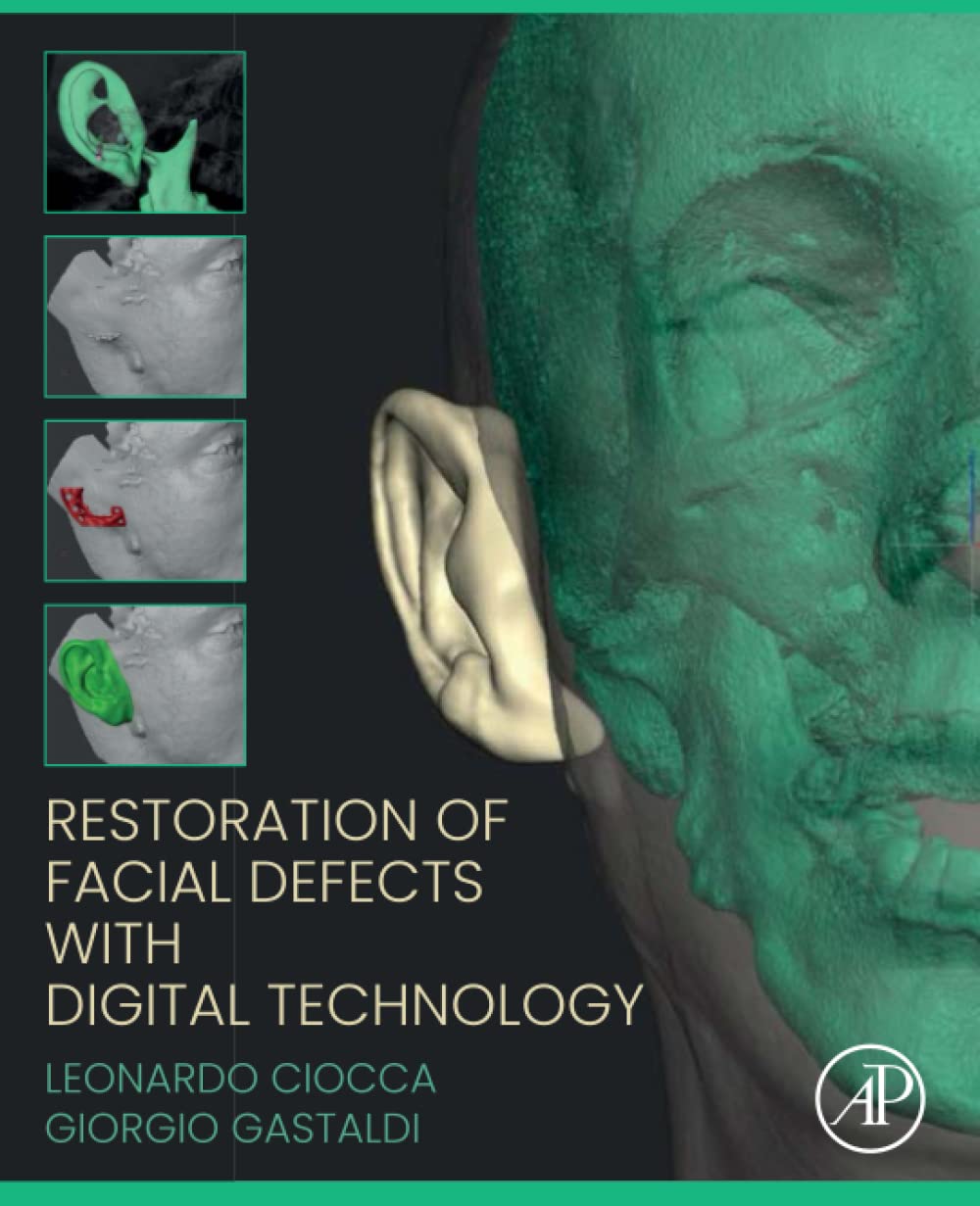 Restoration Of Facial Defects With Digital Technology 1st Edition Leonardo Ciocca
