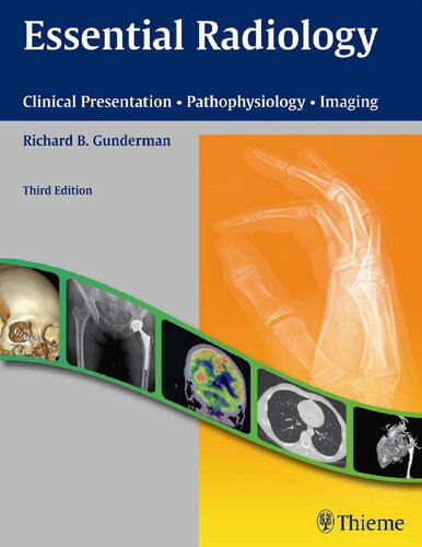 Essential Radiology 3rd Edition Richard B Gunderman