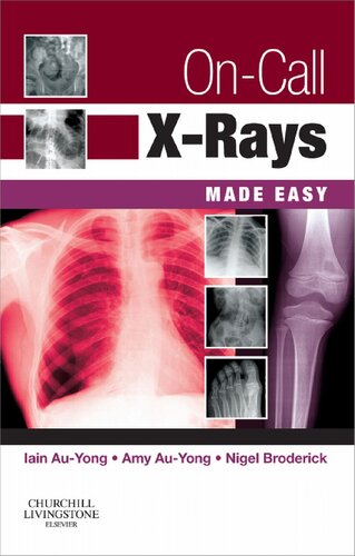 Oncall Xrays Made Easy 1st Edition Iain Auyong Ma Bmbch Mrcs Frcr