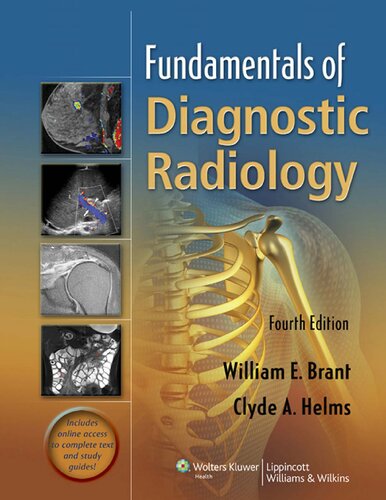 Fundamentals Of Diagnostic Radiology 4th Edition 4th Edition William E Brant And Clyde A Helms Editors