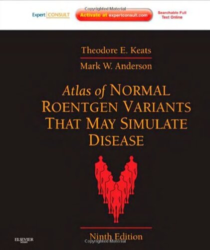 Atlas Of Normal Roentgen Variants That May Simulate Disease 9th Edition Theodore Eliot Keats