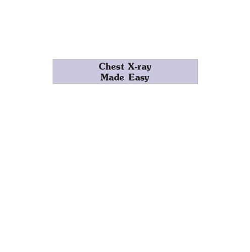 Chest Xray Made Easy 1st Edition Karthikeyan
