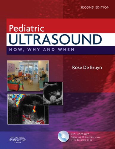 Pediatric Ultrasound How Why And When 2nd Edition Rose De Bruyn Auth Ed