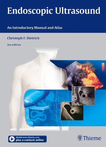Endoscopic Ultrasound An Introductory Manual And Atlas 2nd Edition Christoph Frank Dietrich