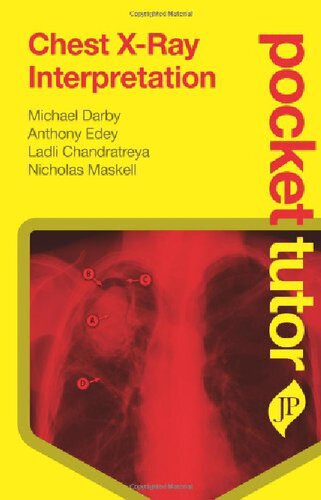 Pocket Tutor Chest Xray Interpretation 1st Edition Michael Darby