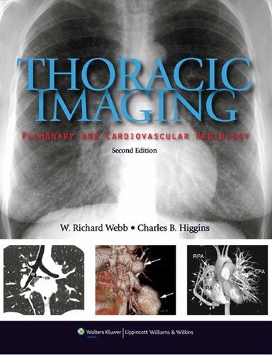 Thoracic Imaging Pulmonary And Cardiovascular Radiology 2nd Edition W Richard Webb
